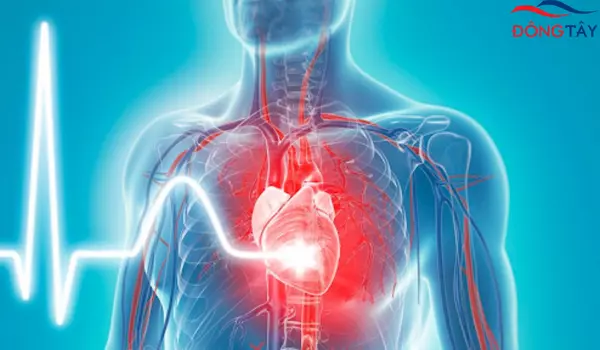 Bị thiếu máu cơ tim có điều trị khỏi hoàn toàn không?